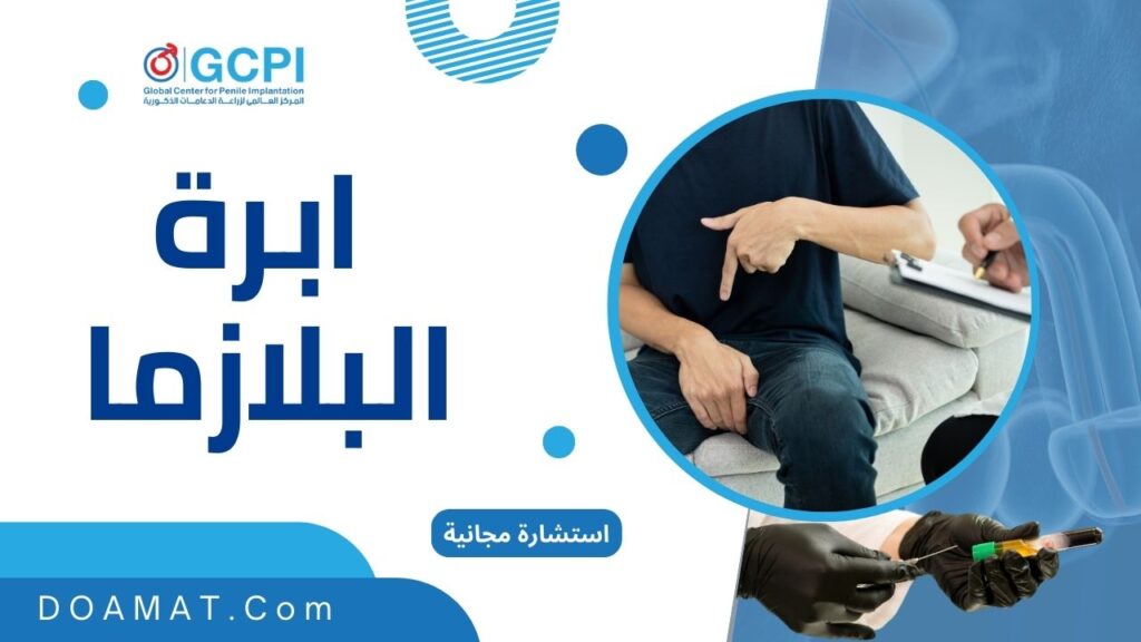 ابرة البلازما او البي شوت ابرة الفحولة